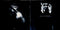 Paul Carrack : Blue Views (CD, Album, RE)