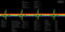 Pink Floyd : The Dark Side Of The Moon (LP, Album, Ltd, RE, RM)