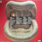 The Rolling Stones : Get Stoned (2xLP, Album, Comp, Mono)
