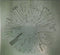 Carcass : Surgical Steel (CD, Album, Dlx, Ltd, Dig)