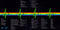 Pink Floyd : The Dark Side Of The Moon (LP, Album, RM, S/Edition, 40t)